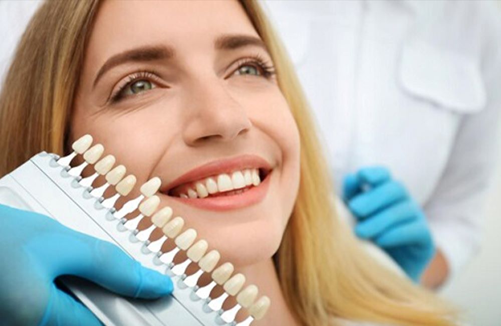 Laminate Veneers Teeth in Turkey Laminate Veneers Teeth in Turkey
